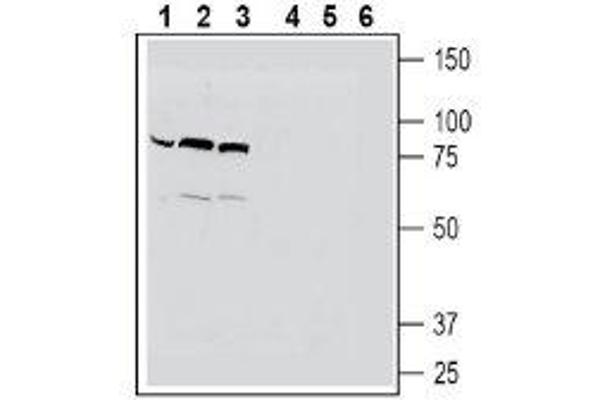 SLC22A4 Antikörper  (C-Term, Intracellular)