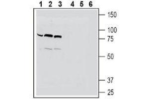 Western blot analysis of human THP-1 monocytic leukemia cell line lysates (lanes 1 and 4), mouse BV-2 microglia cell line lysates (lanes 2 and 5) and human HeLa cervix adenocarcinoma cell line lysates (lanes 3 and 6): - 1-3. (SLC22A4 Antikörper  (C-Term, Intracellular))