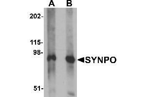 Western Blotting (WB) image for anti-Synaptopodin (SYNPO) (C-Term) antibody (ABIN1030717)