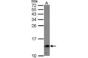 WB Image Sample (30 ug of whole cell lysate) A: A549 15% SDS PAGE antibody diluted at 1:1000 (Ensa Antikörper)