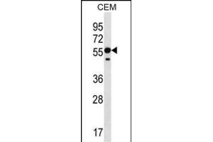 RNF8 Antibody (C-term) (ABIN657354 and ABIN2846404) western blot analysis in CEM cell line lysates (35 μg/lane).