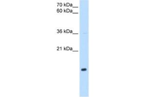 Western Blotting (WB) image for anti-NADH Dehydrogenase (Ubiquinone) 1 beta Subcomplex, 5, 16kDa (NDUFB5) antibody (ABIN2462840) (NDUFB5 Antikörper)