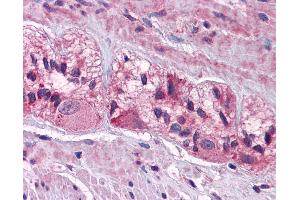 Immunohistochemistry (IHC) image for anti-Cholinergic Receptor, Nicotinic, alpha 3 (Neuronal) (CHRNA3) (AA 35-84) antibody (ABIN6747008)