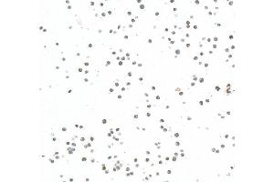 Immunocytochemistry (ICC) image for anti-Enhancer of Zeste Homolog 2 (EZH2) (AA 1-154) antibody (ABIN7795766) (Rekombinanter EZH2 Antikörper  (AA 1-154))
