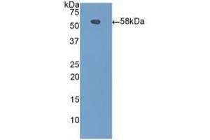 Detection of Recombinant CPN1, Mouse using Polyclonal Antibody to Carboxypeptidase N1 (CPN1) (CPN1 Antikörper  (AA 221-449))