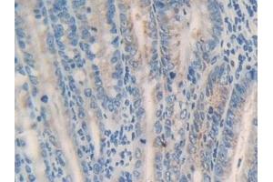 Detection of MGST1 in Mouse Intestine Tissue using Polyclonal Antibody to Microsomal Glutathione S Transferase 1 (MGST1) (MGST1 Antikörper  (AA 8-155))