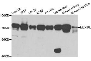 Western blot analysis of extracts of various cell lines, using MLXIPL antibody (ABIN5995539) at 1/1000 dilution. (MLXIPL Antikörper)