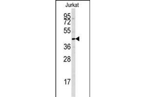 Western blot analysis of anti-PTPN7 Antibody (S44) (ABIN391869 and ABIN2841694) in Jurkat cell line lysates (35 μg/lane). (PTPN7 Antikörper  (AA 22-51))