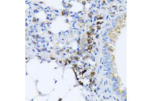 Immunohistochemistry of paraffin-embedded mouse lung using BiP/GRP78 antibody (ABIN3020762, ABIN3020763, ABIN3020764, ABIN1512637 and ABIN6213711) at dilution of 1:100 (40x lens).