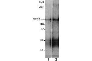 Western blot analysis of Npc1l1 in rat small intestine membrane preparations (Lane 1 : 2 ug/mL , Lane 2 : 4 ug/mL) with Npc1l1 polyclonal antibody .