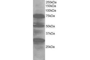 ABIN2563699 staining (1µg/ml) of Human Lung lysate (RIPA buffer, 30µg total protein per lane). (LMO7 Antikörper  (Internal Region))