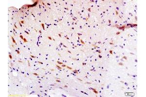 Formalin-fixed and paraffin embedded rat brain labeled with Anti-Sema3F/semaphorin 3F Polyclonal Antibody, Unconjugated  at 1:200 followed by conjugation to the secondary antibody and DAB staining. (SEMA3F Antikörper  (AA 651-754))
