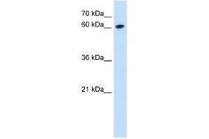 WB Suggested Anti-ZNF169 Antibody Titration:  0.