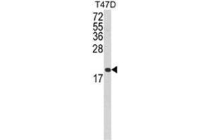 Western blot analysis of FAS Antibody (Center) in T47D cell line lysates (35ug/lane). (FAS Antikörper  (Middle Region))