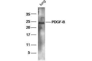 Mouse lung lysates probed with Rabbit Anti-PDGF-B Polyclonal Antibody, Unconjugated  at 1:5000 for 90 min at 37˚C.