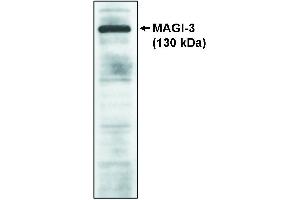 Western blot analysis using MAGI-3, GKWW antibody on cell lysates transfected with full-length human MAGI-3 protein. (SH3BP4 Antikörper)