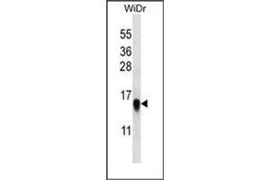 Western blot analysis in WiDr cell line lysates (35 ug/lane) using RPL35 Antibody (C-term) Cat.