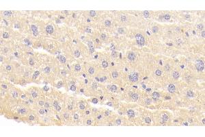 Immunohistochemistry (IHC) image for anti-Ring Finger Protein 112 (RNF112) (AA 403-647) antibody (ABIN7440506)
