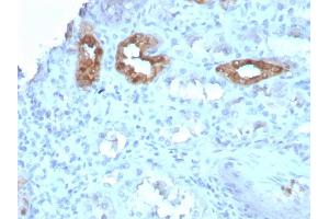 Formalin-fixed, paraffin-embedded human Kidney stained with Calbindin 1 Mouse Monoclonal Antibody (CALB1/3333).