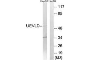 Western blot analysis of extracts from HepG2 cells, using UEVLD Antibody. (UEVLD Antikörper  (AA 141-190))