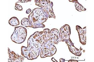 IHC analysis of RPS15A using anti-RPS15A antibody (ABIN7598954). (RPS15A Antikörper  (AA 1-113))