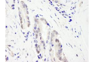 Immunohistochemistry (IHC) image for anti-Chromodomain Helicase DNA Binding Protein 3 (CHD3) (AA 1575-1625) antibody (ABIN7454727)