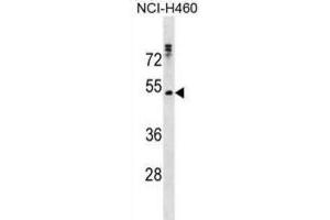 Western Blotting (WB) image for anti-Rh Family C Glycoprotein (RHCG) antibody (ABIN3000734) (RHCG Antikörper)