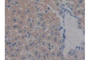 Detection of REG3b in Mouse Liver Tissue using Polyclonal Antibody to Regenerating Islet Derived Protein 3 Beta (REG3b) (REG3B Antikörper  (AA 27-175))