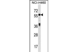 ICA1 Antibody (N-term) (ABIN1539626 and ABIN2848494) western blot analysis in NCI- cell line lysates (35 μg/lane). (ICA1 Antikörper  (N-Term))