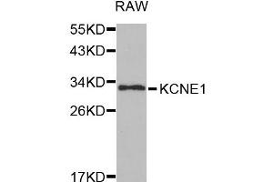 Western blot analysis of extracts of RAW cell line, using KCNE1 antibody. (KCNE1 Antikörper)