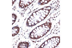 Immunohistochemistry (IHC) image for anti-Nucleoporin 153kDa (NUP153) antibody (ABIN1512527)
