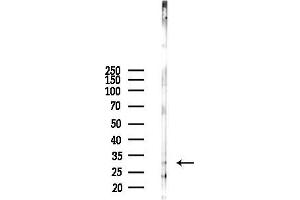 anti-Proteolipid Protein 1 (PLP1) (Internal Region) antibody