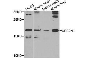 Western blot analysis of extracts of various cell lines, using UBE2NL antibody. (UBE2NL Antikörper  (AA 1-100))