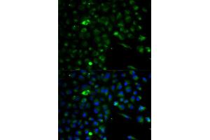 Immunofluorescence analysis of A549 cell using ALDH1A1 antibody. (ALDH1A1 Antikörper  (AA 48-147))