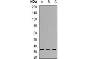 Western blot analysis of Tropomyosin 2 expression in Hela (A), MCF7 (B), mouse lung (C) whole cell lysates. (TPM2 Antikörper)