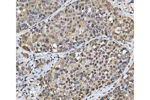 IHC analysis of SCML1 using anti-SCML1 antibody (ABIN7602479).
