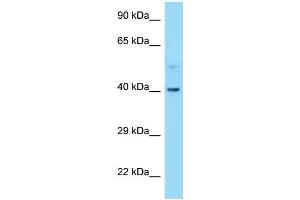 WB Suggested Anti-CNR2 Antibody Titration: 1. (CNR2 Antikörper  (C-Term))