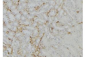 Immunohistochemistry (IHC) image for anti-KDEL (Lys-Asp-Glu-Leu) Endoplasmic Reticulum Protein Retention Receptor 1 (KDELR1) (Internal Region) antibody (ABIN6262763)