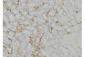 ABIN6274020 at 1/100 staining Mouse kidney tissue by IHC-P.
