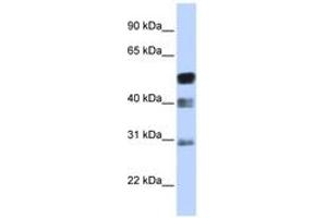 Image no. 1 for anti-Transcription Factor AP-2 beta (Activating Enhancer Binding Protein 2 Beta) (TFAP2B) (AA 35-84) antibody (ABIN6742379) (TFAP2B Antikörper  (AA 35-84))
