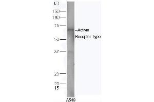 Western Blotting (WB) image for anti-Activin A Receptor, Type IIB (ACVR2B) (AA 45-150) antibody (ABIN1714650)