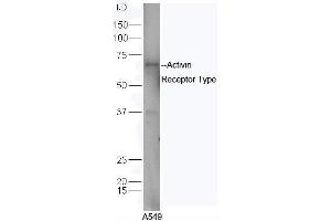 Human A549 cell lysates probed with Rabbit Anti-ACVR2B/ACTR-IIB Polyclonal Antibody, Unconjugated  at 1:5000 for 90 min at 37˚C. (ACVR2B Antikörper  (AA 45-150))