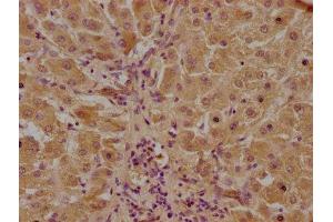 IHC image of ABIN7146046 diluted at 1:100 and staining in paraffin-embedded human liver tissue performed on a Leica BondTM system. (CLEC1A Antikörper  (AA 66-316))