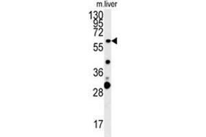 Western Blotting (WB) image for anti-Zinc Finger, CCHC Domain Containing 5 (ZCCHC5) (AA 45-75), (N-Term) antibody (ABIN955643)