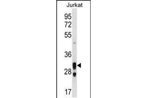 Western blot analysis in Jurkat cell line lysates (35ug/lane). (ACER1 Antikörper  (C-Term))