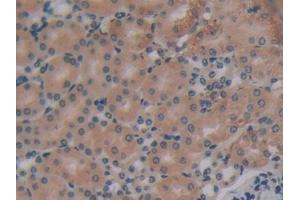 DAB staining on IHC-P; Samples: Mouse Kidney Tissue (EIF2AK2 Antikörper  (AA 205-495))