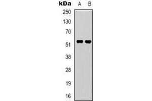 Western blot analysis of GPR37L1 expression in A549 (A), Hela (B) whole cell lysates. (GPR37L1 Antikörper  (N-Term))