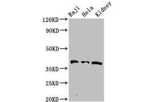 Western Blot Positive WB detected in: Raji whole cell lysate, Hela whole cell lysate, Mouse kidney tissue All lanes: RFC4 antibody at 2. (RFC4 Antikörper  (AA 9-142))