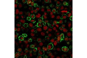 Analysis of Protein Array containing more than 19,000 full-length human proteins using CD20 Monospecific Recombinant Mouse Monoclonal Antibody (rIGEL/773). (Rekombinanter CD20 Antikörper)