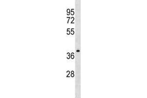 NDRG4 antibody western blot analysis in CEM lysate. (NDRG4 Antikörper  (AA 193-220))
